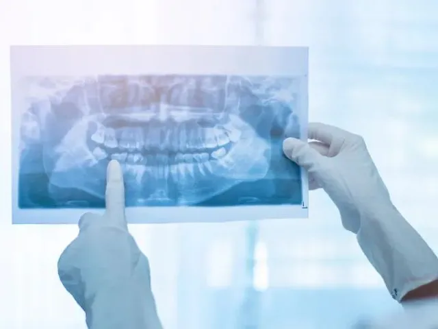 Imagem: Centro de Radiologia Odontológica À Venda